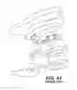 Fig. 35 - Footwear devices with an outer bladder and a foamed plastic internal structure separated by an internal flexibility sipe