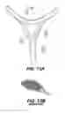 Fig. 52 - Footwear devices with an outer bladder and a foamed plastic internal structure separated by an internal flexibility sipe