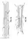 Fig. 12 - Belt and/or buckle assembly