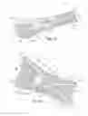 Fig. 02 - Snowshoe