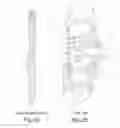 Fig. 06 - Snowshoe