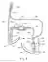 Fig. 08 - Co-extruded U-channel with integrated glassrun