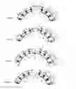 Fig. 14 - STRUCTURAL MEMBER