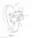 Fig. 05 - Combustion Chamber End Cover Without Welding or Brazing