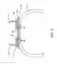 Fig. 03 - Multi-size adjustable castings for jewelry