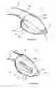 Fig. 15 - Artificial airway
