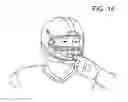 Fig. 06 - PROTECTIVE MOUTH GUARD