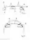 Fig. 04 - Covering device for an interior of an aircraft and a method for covering an interior of an aircraft
