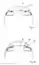 Fig. 05 - Covering device for an interior of an aircraft and a method for covering an interior of an aircraft
