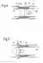 Fig. 03 - System and method for anchoring an expandable tubular to a borehole wall