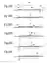 Fig. 09 - System and method for anchoring an expandable tubular to a borehole wall