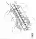Fig. 03 - Shrinkable sleeve stabilizer