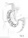 Fig. 09 - Brake disc implemented as a casting and method of making same