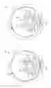 Fig. 05 - Lid for containers of substances and container of substances thus equipped
