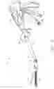 Fig. 03 - Surgical instrument having recording capabilities