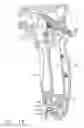 Fig. 18 - Surgical instrument having recording capabilities