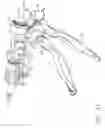 Fig. 33 - Surgical instrument having recording capabilities