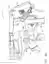 Fig. 46 - Surgical instrument having recording capabilities