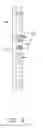 Fig. 04 - Mounting apparatus for slide rail
