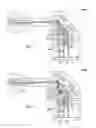 Fig. 06 - Autofocus system with stray light compensation