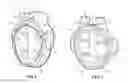 Fig. 02 - THERMOPLASTIC COMPOSITE BASED GATE VALVE