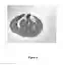 Fig. 09 - Laser protection polymeric materials