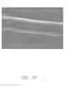 Fig. 11 - Epitaxial structure