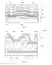 Fig. 09 - Radiation imaging device, radiation imaging display system, and transistor