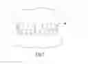 Fig. 02 - METHOD OF PRODUCING AN INDIVIDUALIZED TOOTH VENEER AND A HOLDER