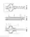 Fig. 02 - Shape memory material packer for subterranean use