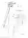 Fig. 15 - Wheelchair handlebar adjustment