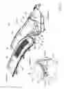 Fig. 04 - Cowl louver support structure for automobile