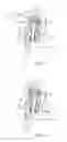 Fig. 05 - Adjustment structure for chair armrest