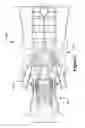 Fig. 02 - Methods, systems and apparatus for detecting material defects in combustors of combustion turbine engines
