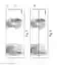 Fig. 06 - Generating composite medical images