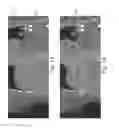 Fig. 10 - Generating composite medical images