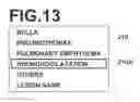 Fig. 12 - IMAGE INTERPRETATION REPORT GENERATION APPARATUS, METHOD AND PROGRAM
