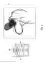 Fig. 04 - METHOD AND SYSTEM FOR IMPROVED MEDICAL IMAGE ANALYSIS