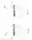 Fig. 11 - ROTATIONAL ADJUSTMENT FOR STEREO VIEWING