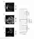 Fig. 11 - Methods and system for validating sample images for quantitative immunoassays