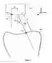 Fig. 07 - Optical coherence tomography imaging
