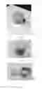 Fig. 13 - Illumination apparatus