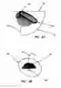 Fig. 10 - LED device for wide beam generation