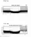Fig. 09 - Frequency dependent I/Q imbalance compensation