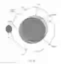 Fig. 32 - Orthovoltage radiotherapy