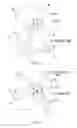 Fig. 12 - Ear speaker device