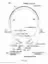 Fig. 16 - Ear speaker device