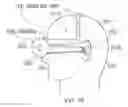 Fig. 56 - Ear speaker device