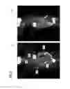 Fig. 05 - Methods and apparatus for generating a modified intensity projection image