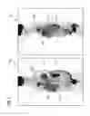 Fig. 06 - Methods and apparatus for generating a modified intensity projection image
